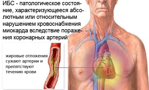 Изображение - Таблетки понижающие давление список tabletki-ot-vysokogo-davleniya-perechen-naimenovanij-2