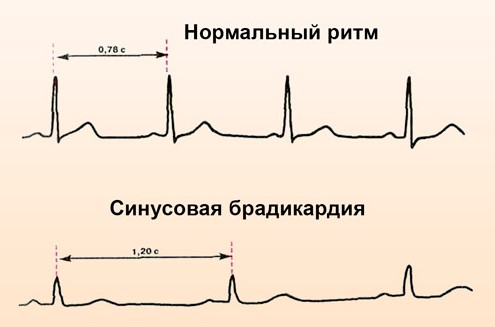 Изображение - Давление пульс у беременных norma-pri-beremennosti-6