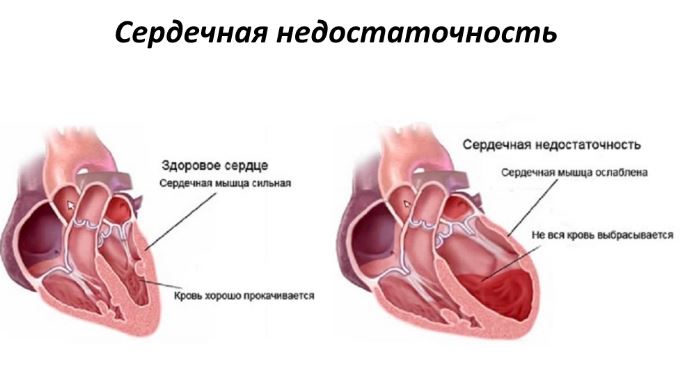Изображение - Пульс выше давления сердца povyshennyj-puls-prichiny-ot-chego-mozhet-byt-5
