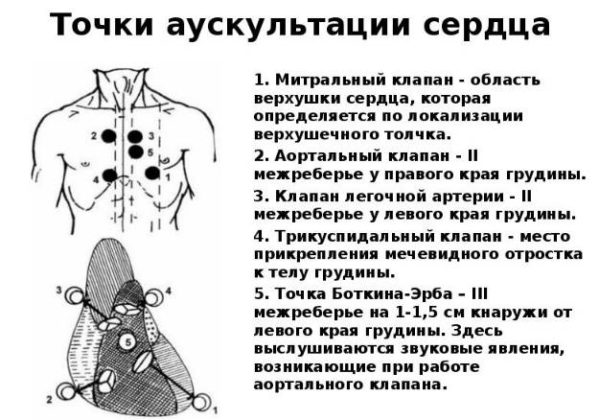 Место выслушивания митрального клапана