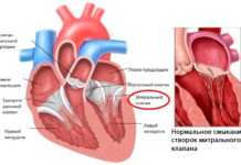 Митральный клапан сердца: где расположен, его функции
